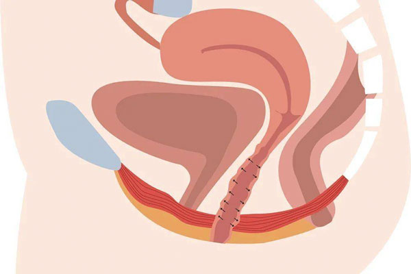 解析产后阴道痉挛症状和原因分析